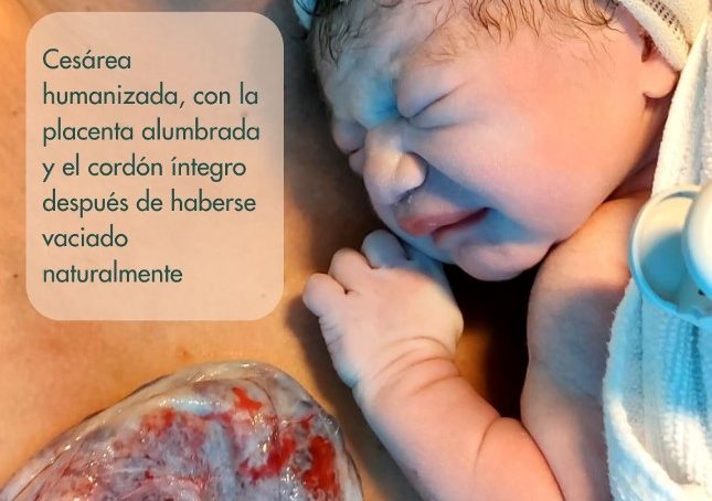 pinzamiento fisiológico del cordón en cesárea